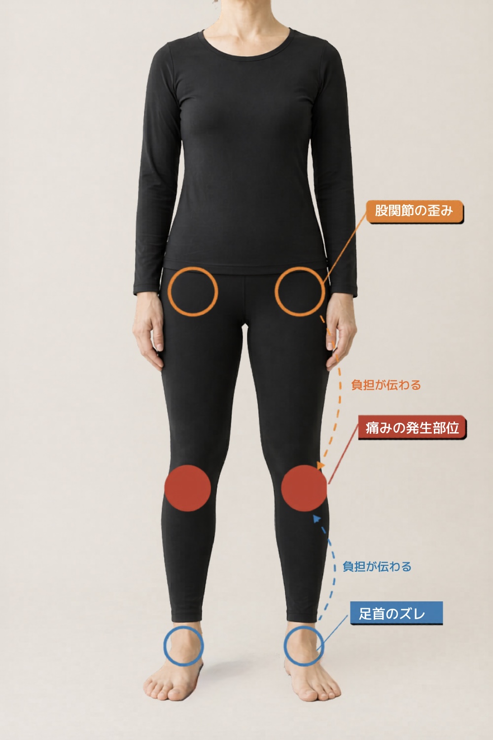 膝に負担が集まる3つの原因箇所