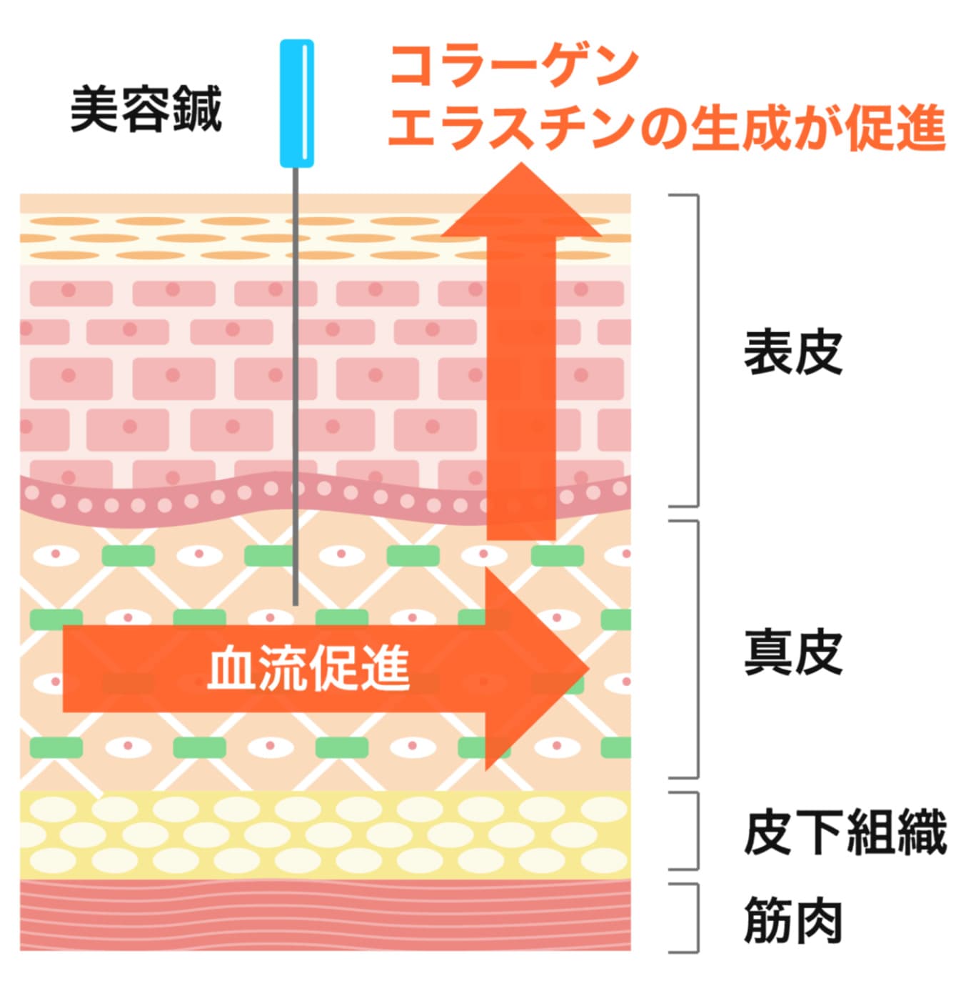 美容鍼後の肌の修復メカニズム